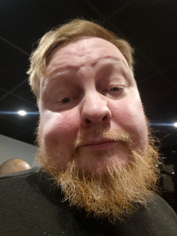Mattias Andersson